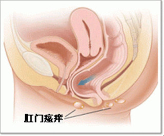 阜阳兆岐肛肠医院